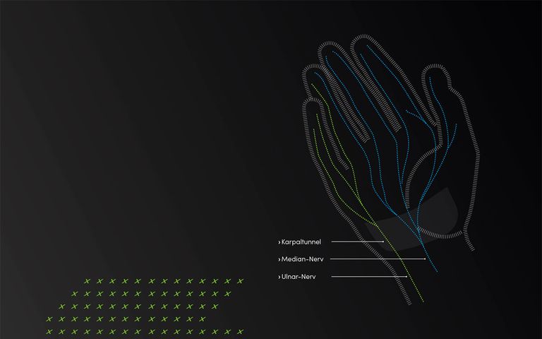 Warum schlafen die Hände ein?