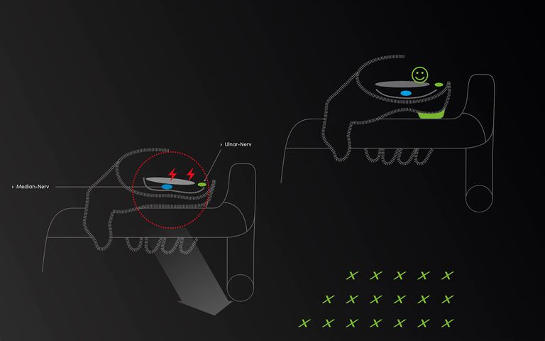 Ein neues gefühl dank Bioxcell